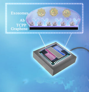 Rapid diagnosis of pancreatic cancer with graphene sensor array